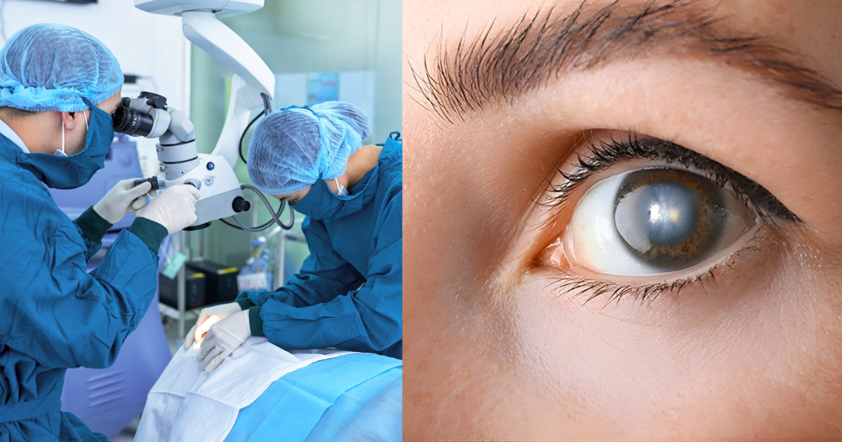 Cirurgia de Catarata em Vila Velha – dúvidas frequentes