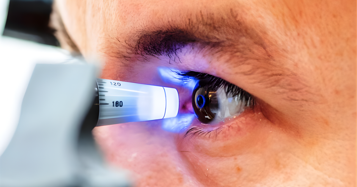 Glaucoma: o guia completo sobre o inimigo silencioso da visão